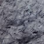 P2RX6 Antibody in Immunohistochemistry - Free Floating (IHC (Free))