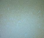 KCNQ1 Antibody in Immunohistochemistry (Paraffin) (IHC (P))