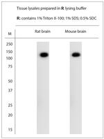 KCNT1 Antibody in Western Blot (WB)