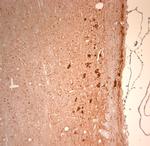 KCNH2 Antibody in Immunohistochemistry (Paraffin) (IHC (P))