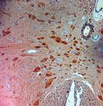 PGP 9.5 Antibody in Immunohistochemistry (Paraffin) (IHC (P))