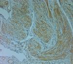 Perilipin 4 Antibody in Immunohistochemistry (Paraffin) (IHC (P))