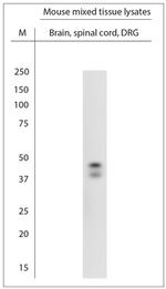 POC1A Antibody in Western Blot (WB)