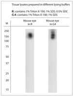 TRPM1 Antibody in Western Blot (WB)