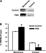 TRPM4 Antibody in Western Blot (WB)