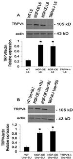 TRPV4 Antibody in Western Blot (WB)