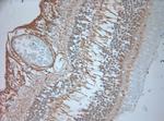 GPR143 Antibody in Immunohistochemistry (Paraffin) (IHC (P))
