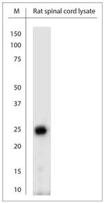 RhoF Antibody in Western Blot (WB)