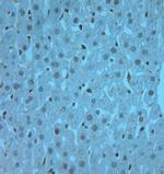 RAB6A/RAB6C Antibody in Immunohistochemistry (Paraffin) (IHC (P))