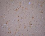 RYR1 Antibody in Immunohistochemistry (Paraffin) (IHC (P))