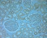 REEP5 Antibody in Immunohistochemistry (Paraffin) (IHC (P))