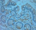 REEP5 Antibody in Immunohistochemistry (Paraffin) (IHC (P))