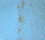 REEP5 Antibody in Immunohistochemistry (Paraffin) (IHC (P))