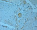 REEP5 Antibody in Immunohistochemistry (Paraffin) (IHC (P))