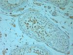 REEP5 Antibody in Immunohistochemistry (Paraffin) (IHC (P))