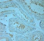 REEP5 Antibody in Immunohistochemistry (Paraffin) (IHC (P))