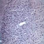 Sortilin Antibody in Immunohistochemistry (IHC)