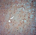 Syntaxin 6 Antibody in Immunohistochemistry (Paraffin) (IHC (P))