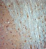 Syntaxin 6 Antibody in Immunohistochemistry (Paraffin) (IHC (P))