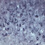 SEC22B Antibody in Immunohistochemistry (IHC)