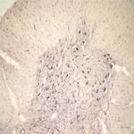 Sortilin Polyclonal Antibody