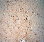 Synaptoporin Antibody in Immunohistochemistry (Paraffin) (IHC (P))