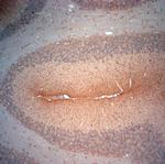 Synaptoporin Antibody in Immunohistochemistry (Paraffin) (IHC (P))