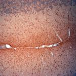 Synaptoporin Antibody in Immunohistochemistry (Paraffin) (IHC (P))