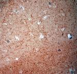 Synaptoporin Antibody in Immunohistochemistry (Paraffin) (IHC (P))