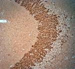 Synaptoporin Antibody in Immunohistochemistry (Paraffin) (IHC (P))