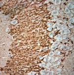 Synaptoporin Antibody in Immunohistochemistry (Paraffin) (IHC (P))