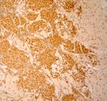 Synaptoporin Antibody in Immunohistochemistry (Paraffin) (IHC (P))