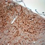 Synaptoporin Antibody in Immunohistochemistry (Paraffin) (IHC (P))