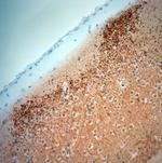 Synaptoporin Antibody in Immunohistochemistry (Paraffin) (IHC (P))