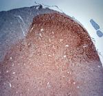 Synaptoporin Antibody in Immunohistochemistry (Paraffin) (IHC (P))