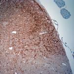 Synaptoporin Antibody in Immunohistochemistry (Paraffin) (IHC (P))