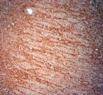 Synaptoporin Antibody in Immunohistochemistry (Paraffin) (IHC (P))