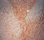 Synaptoporin Antibody in Immunohistochemistry (Paraffin) (IHC (P))