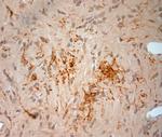 Synaptoporin Antibody in Immunohistochemistry (Paraffin) (IHC (P))