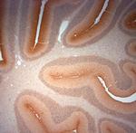 Synaptoporin Antibody in Immunohistochemistry (Paraffin) (IHC (P))