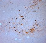 SNIP Antibody in Immunohistochemistry (Paraffin) (IHC (P))