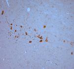 SNIP Polyclonal Antibody