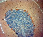 STIM1 Antibody in Immunohistochemistry (Paraffin) (IHC (P))