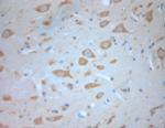SNAP 47 Antibody in Immunohistochemistry (Paraffin) (IHC (P))