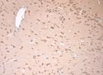 SNAP 47 Antibody in Immunohistochemistry (Paraffin) (IHC (P))