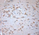 SNAP 47 Antibody in Immunohistochemistry (Paraffin) (IHC (P))