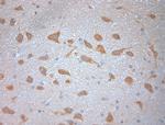 SNAP 47 Antibody in Immunohistochemistry (Paraffin) (IHC (P))