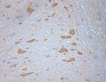SNAP 47 Antibody in Immunohistochemistry (Paraffin) (IHC (P))