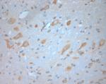 SNAP 47 Antibody in Immunohistochemistry (Paraffin) (IHC (P))