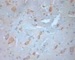 SNAP 47 Antibody in Immunohistochemistry (Paraffin) (IHC (P))